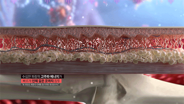 db85df9503f0665be07ffe551631c805_1783909759_7938_1783911510.gif